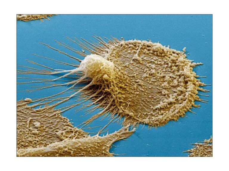 Colored scanning electron micrograph of a dendritic cell.